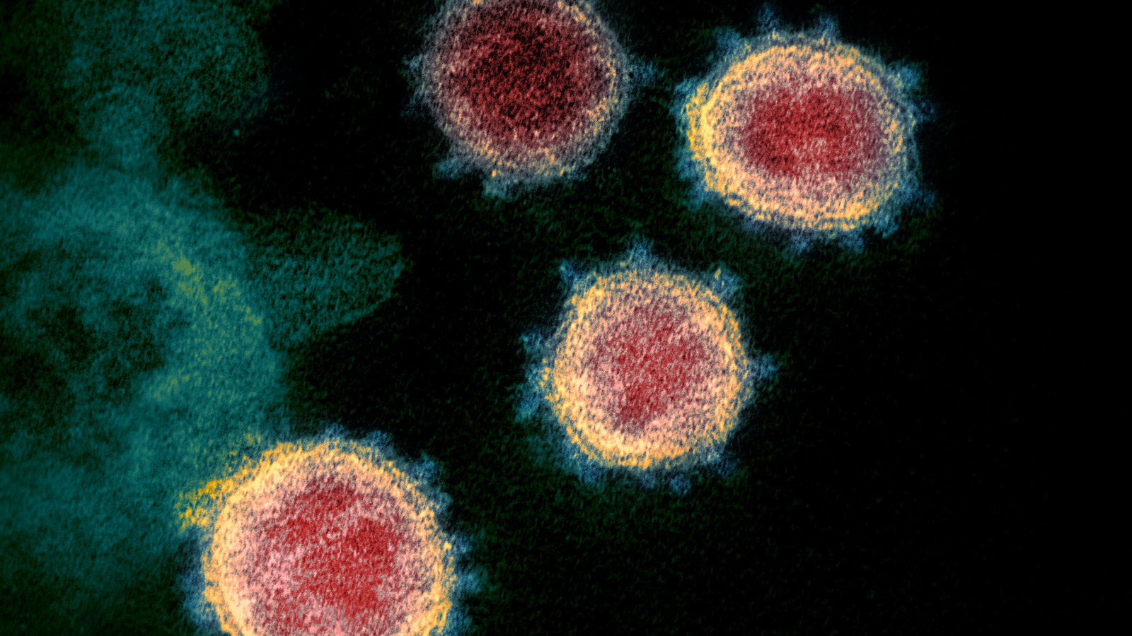 virus
