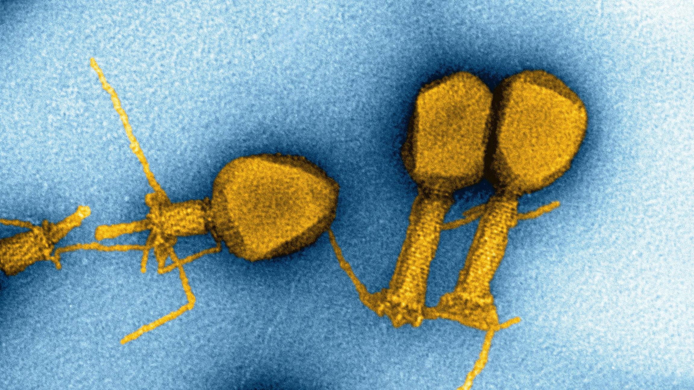 virus